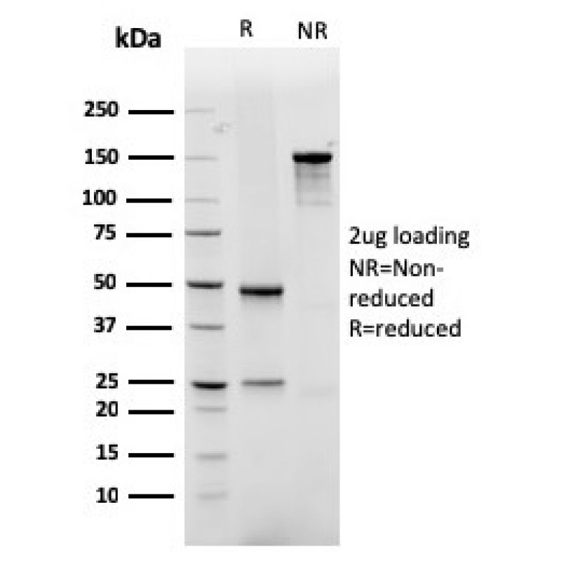 GLUT-1 (Tumor Progression and Mesothelioma Marker)(rGLUT1/2476), 1mg/mL