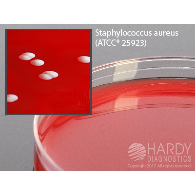 Hardy Diagnostic A50 Dry Culture Media, Columbia CNA Agar Plate,  80 Day Shelf Life (Pack of 10)