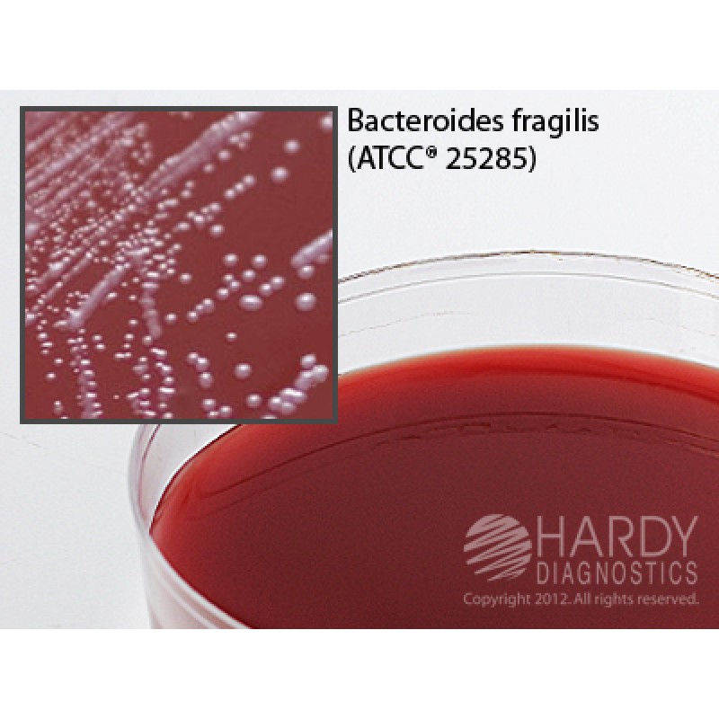 Hardy Diagnostic A62 Dry Culture Media, Neomycin Anaerob Bld Agar Plate,  90 Day Shelf Life (Pack of 10)