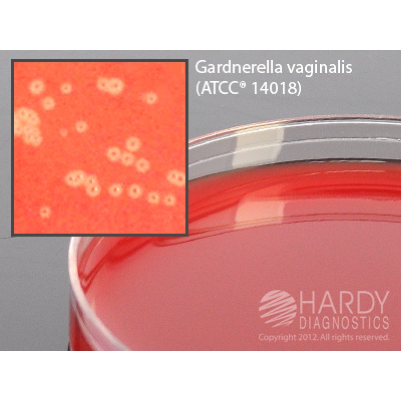 Hardy Diagnostic A81 Dry Culture Media, V Agar w/ CNA Plate,  42 Day Shelf Life (Pack of 10)