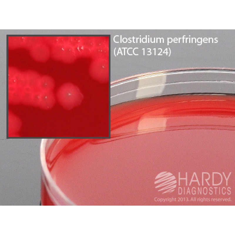 Hardy Diagnostic A98 Dry Culture Media, Schaedler Agar w/ SB Plate,  90 Day Shelf Life (Pack of 10)