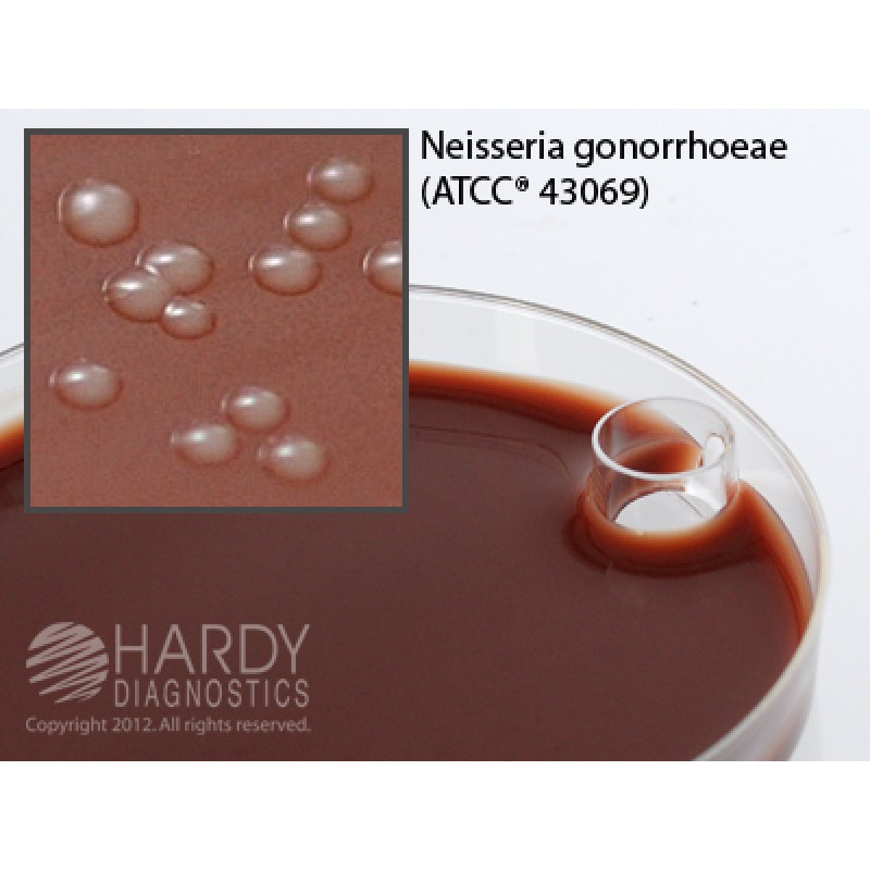 Hardy Diagnostic E31 Dry Culture Media, Martin Lewis w/ Lincomycin Plate,  90 Day Shelf Life (Pack of 10)