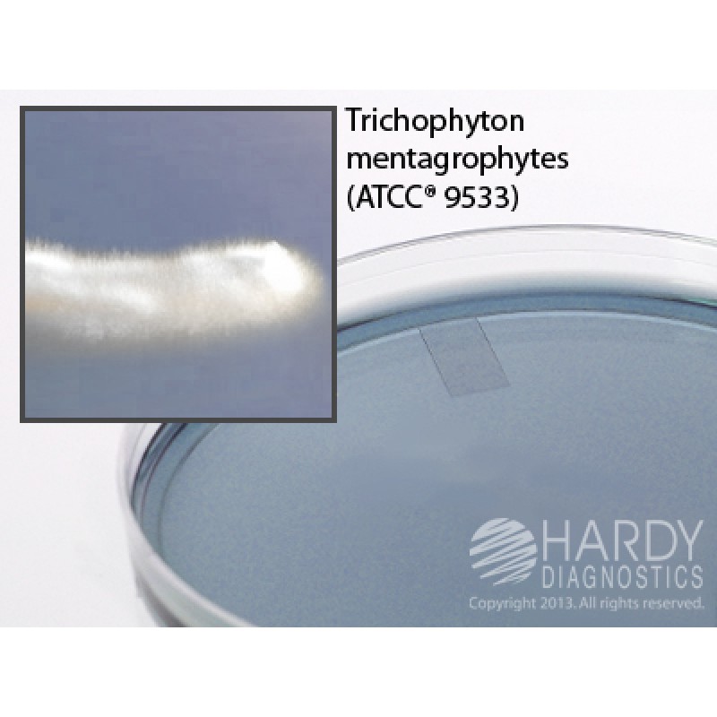 Hardy Diagnostic G01 Dry Culture Media, YM-11 Agar Plate,  100 Day Shelf Life (Pack of 10)