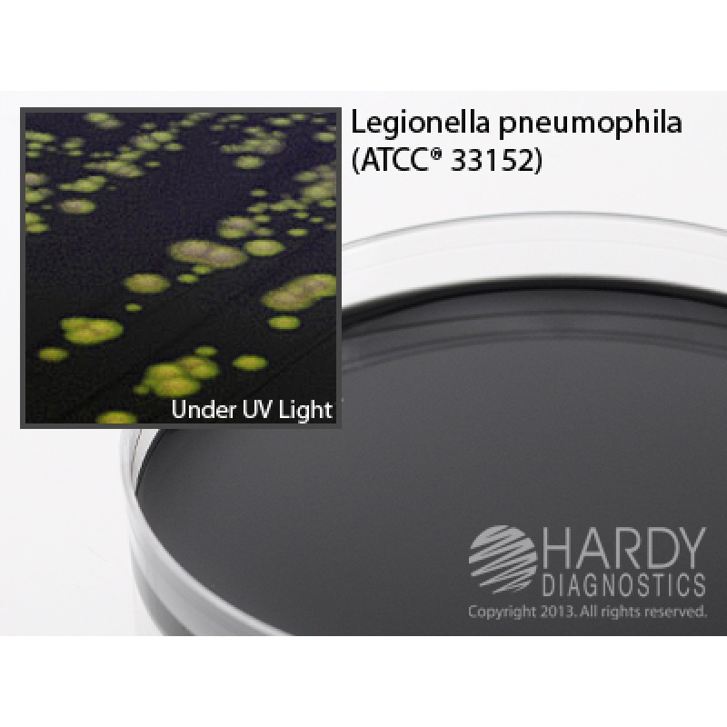 Hardy Diagnostic G108 Dry Culture Media, BCYE Agar w/ o Cysteine Plate,  90 Day Shelf Life (Pack of 10)