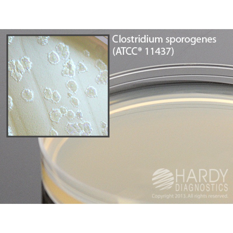 Hardy Diagnostic G215 Liquid Culture Media, Egg Yolk Agar Plate,  90 Day Shelf Life (Pack of 10)