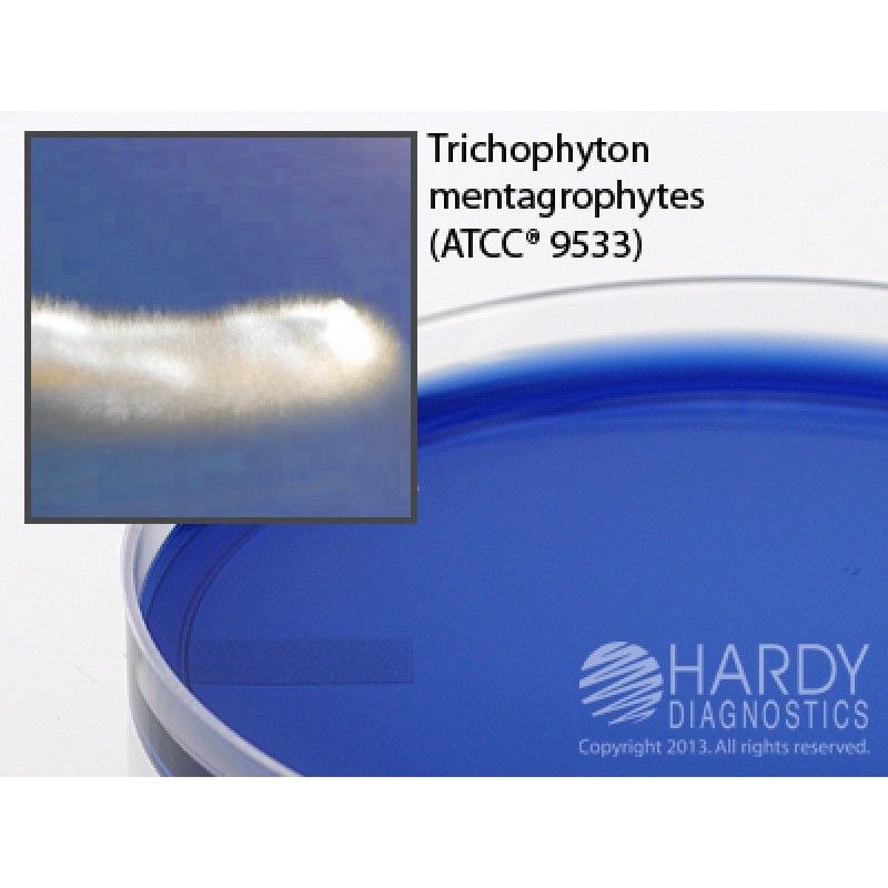 Hardy Diagnostic G265 Dry Culture Media, ETA w/ Antibiotics Plate,  70 Day Shelf Life (Pack of 10)