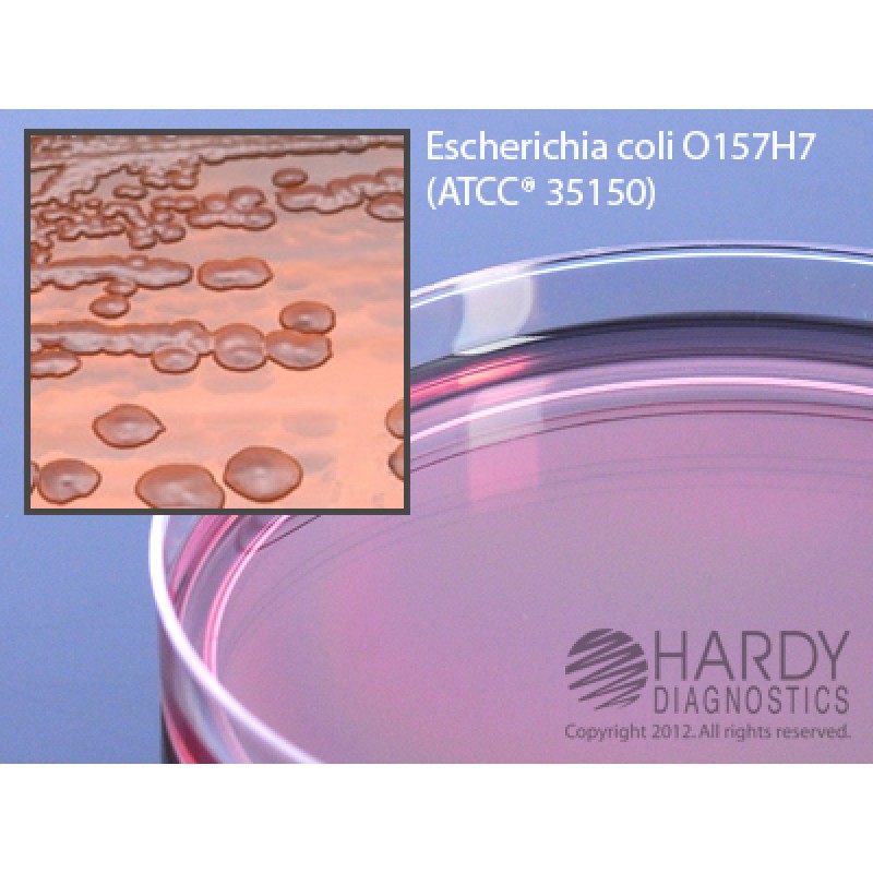 Hardy Diagnostic G36 Dry Culture Media, MacConkey Agar w/ Sorbitol Plate,  90 Day Shelf Life (Pack of 10)
