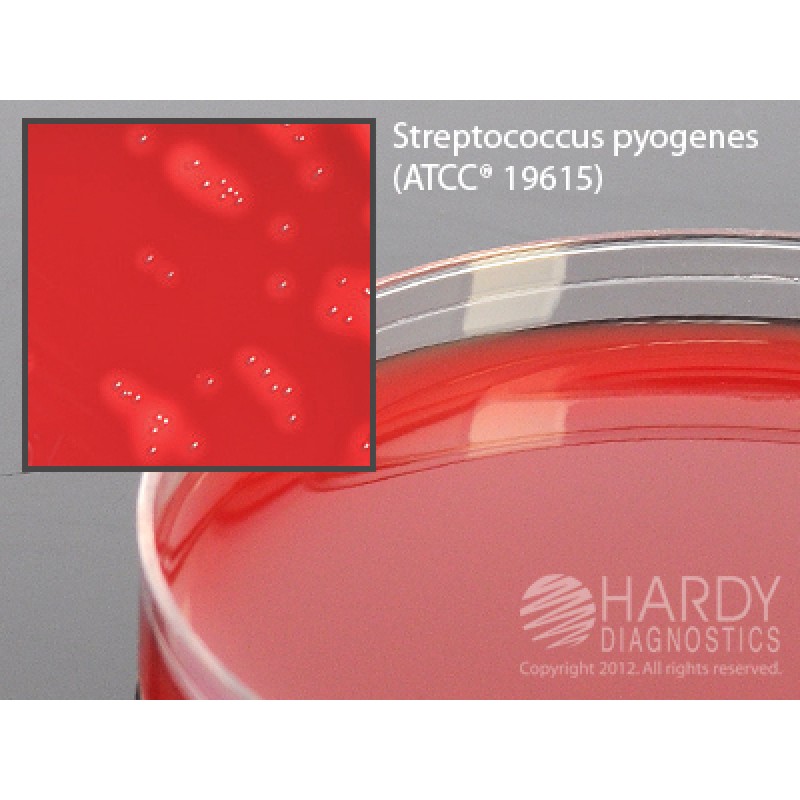 Hardy Diagnostic H28 Dry Culture Media,  Blood Agar 5% Plate,  90 Day Shelf Life (Pack of 10)