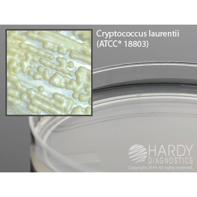 Hardy Diagnostic H91 Dry Culture Media, Yeast Nitrogen Agar Base Plate,  90 Day Shelf Life (Pack of 10)