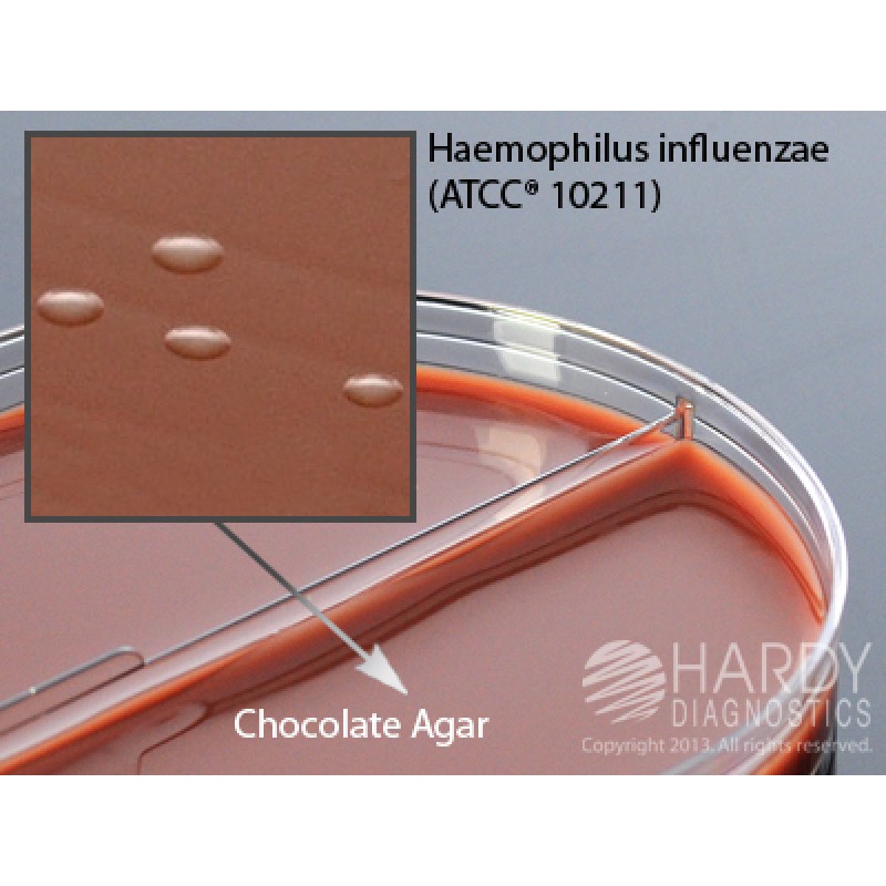 Hardy Diagnostic J101 Dry Culture Media, Chocolate w/ Bac./MTM Biplate,  70 Day Shelf Life (Pack of 10)