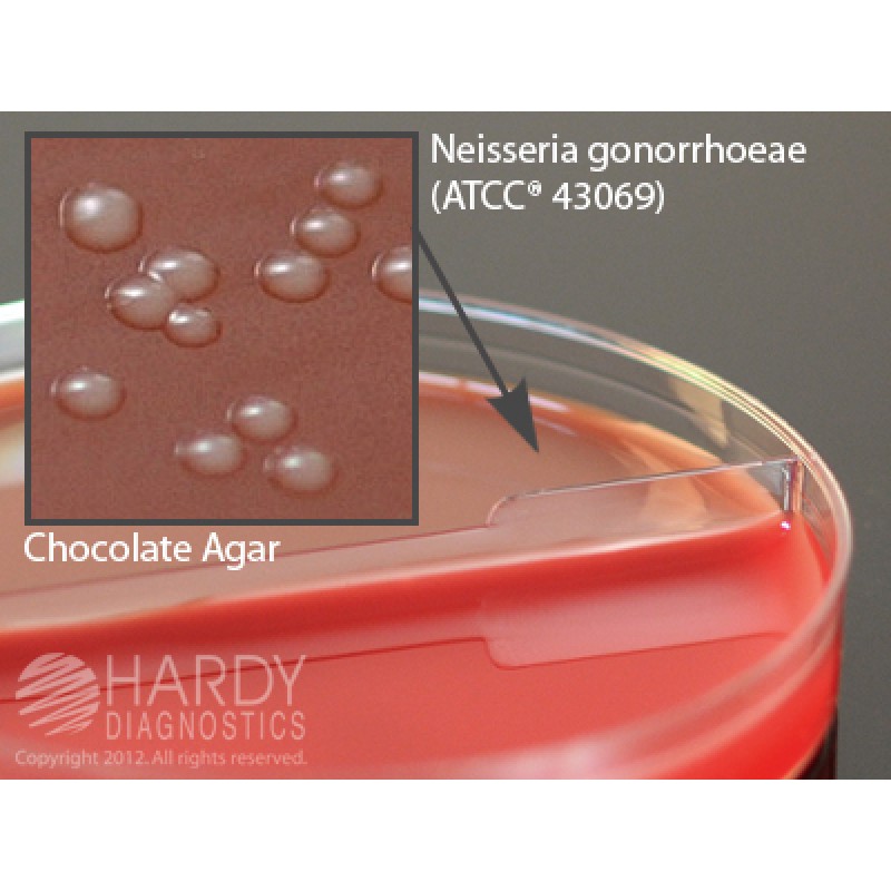 Hardy Diagnostic J42 Dry Culture Media, Blood Agar 5%/Chocolate Biplate,  90 Day Shelf Life (Pack of 10)