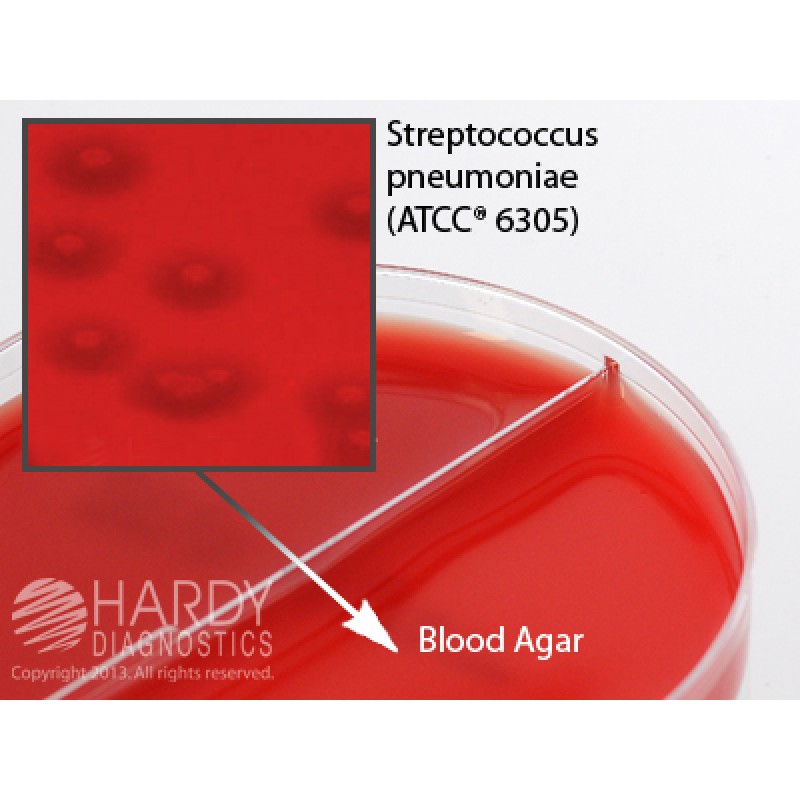 Hardy Diagnostic J92 Dry Culture Media, Grp A Beta Strep/Blood 5% Biplate,  90 Day Shelf Life (Pack of 10)