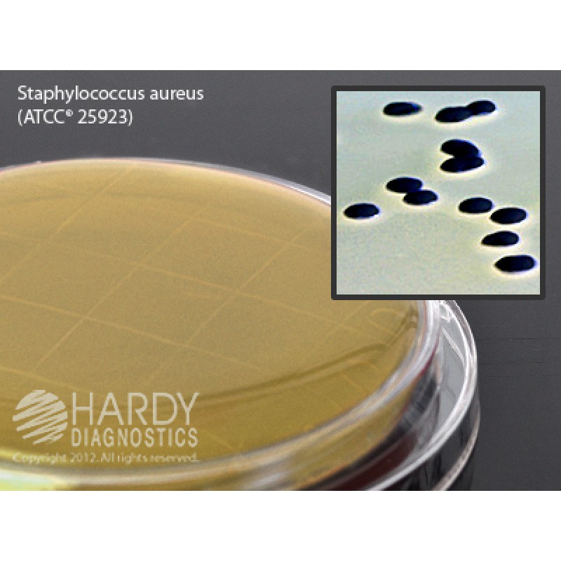 Hardy Diagnostic P16 Dry Culture Media, Baird Parker Agar Contact Plate,  90 Day Shelf Life (Pack of 10)