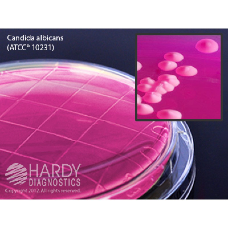 Hardy Diagnostic P42 Dry Culture Media, Rose Bengal Agar w/ Chlorineoram Contact Plate,  90 Day Shelf Life (Pack of 10)