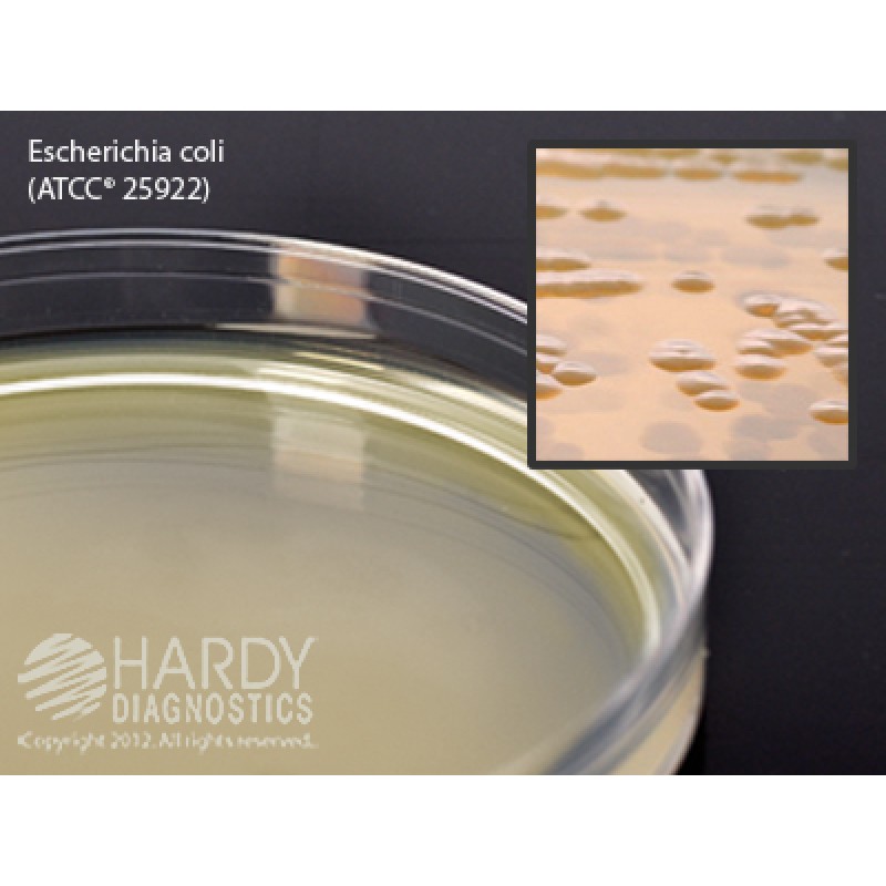 Hardy Diagnostic W163 Liquid Culture Media, BHI Agar Plate,  60 mL, 90 Day Shelf Life (Pack of 5)