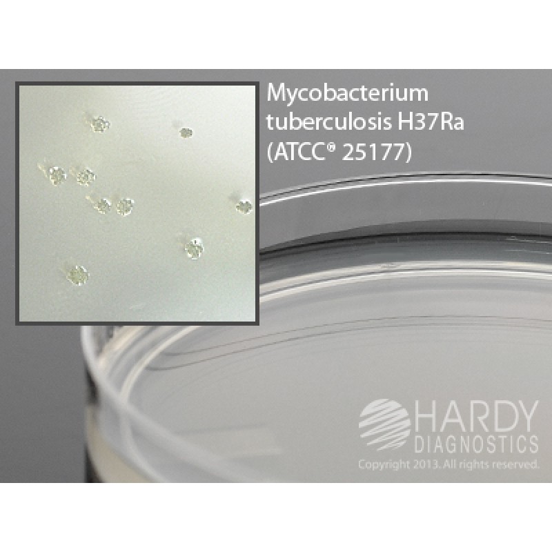 Hardy Diagnostic W30 Dry Culture Media, Middlebrook 7H10 Plate,  120 Day Shelf Life (Pack of 10)