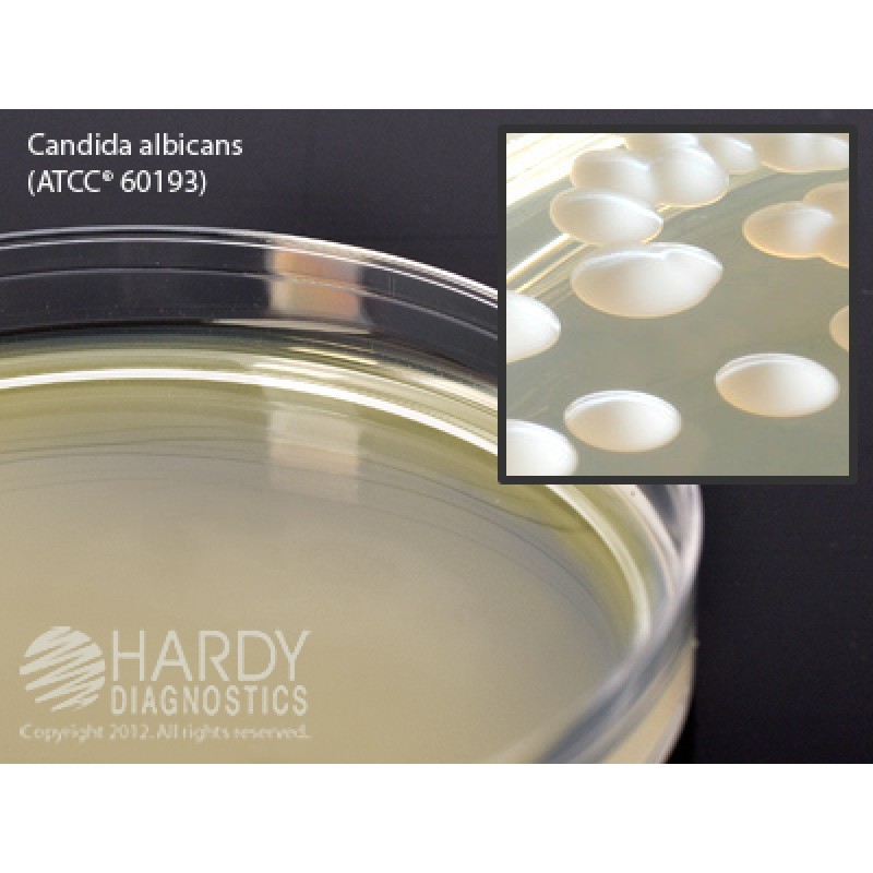 Hardy Diagnostic W70 Dry Culture Media, Sabdex Agar Plate,  90 Day Shelf Life (Pack of 10)