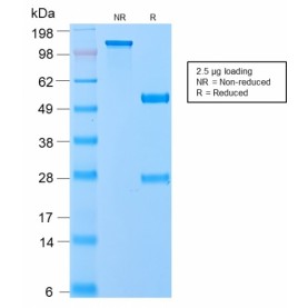 VLDL-Receptor (Very Low Density Lipoprotein Receptor)(VLDLR/2896R), CF405S conjugate, 0.1mg/mL
