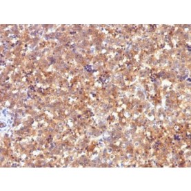 AFP (Alpha Fetoprotein)(C2), CF640R conjugate, 0.1mg/mL