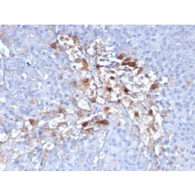 CD146 / MCAM / MUC18 / Mucin 18(C146/634), CF640R conjugate, 0.1mg/mL