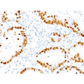 TTF-1 / NKX2.1(NX2.1/690), CF640R conjugate, 0.1mg/mL