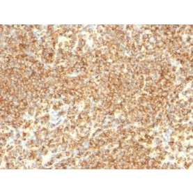 CD20(IGEL/773), CF640R conjugate, 0.1mg/mL