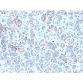 TYRP1 (Tyrosinase Related Protein 1)(TA99), CF640R conjugate, 0.1mg/mL