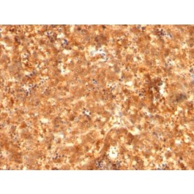 AFP (Alpha Fetoprotein)(C2 + C3 + MBS-12), CF640R conjugate, 0.1mg/mL