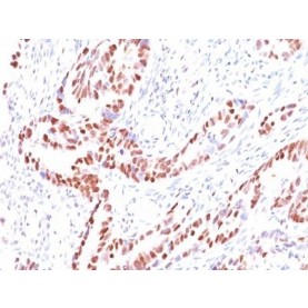 p57 / KIP2(KIP2/880), CF640R conjugate, 0.1mg/mL