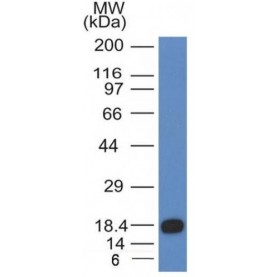 CD117(KIT/983), CF640R conjugate, 0.1mg/mL