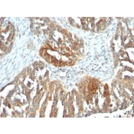 VEGF-A(VEGF/1063), CF640R conjugate, 0.1mg/mL