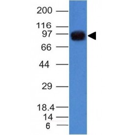 UACA / Nucling(UACA/1222), CF640R conjugate, 0.1mg/mL