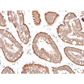 Villin (GI-Mucosal & Urogenital Brush Border Marker)(VIL1/1314 + VIL1/2376), CF640R conjugate, 0.1mg/mL