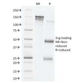 VEGF (Vascular Endothelial Growth Factor)(VG76e), CF640R conjugate, 0.1mg/mL