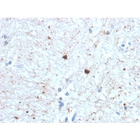Ubiquitin (Autophagy Marker) (UBB/1748), CF640R conjugate, 0.1mg/mL