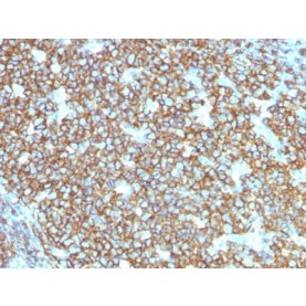 CD20 / MS4A1 (B-Cell Marker) (rIGEL/773), CF640R conjugate, 0.1mg/mL