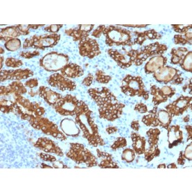 TPO (Thyroid Peroxidase) (Thyroid Marker) (TPO/1922), CF640R conjugate, 0.1mg/mL