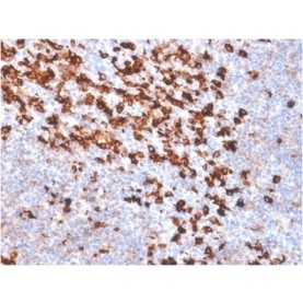 Biotium BNC402032-500, Biotin (Vitamin B7 or Vitamin H) (BTN/2032R), CF640R conjugate, 0.1mg/mL