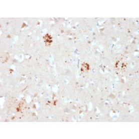 Ubiquitin (Autophagy Marker) (UBB/2122), CF640R conjugate, 0.1mg/mL