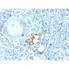TRAcP (Tartrate-Resistant Acid Phosphatase) (Hairy Cell Leukemia Marker) (ACP5/2336R), CF640R conjugate, 0.1mg/mL