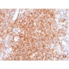 Biotium BNC402383-100, CD40 / TNFRSF5 / CD40L-Receptor (C40/2383), CF640R conjugate, 0.1mg/mL