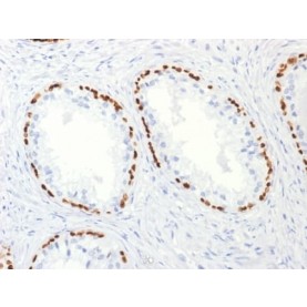 p63 (Squamous, Basal & Myoepithelial Cell Marker) (TP63/2427), CF640R conjugate, 0.1mg/mL