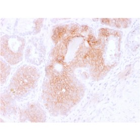 CD44v6 (Marker of Tumor Metastasis)(CD44V6/2496), CF640R conjugate, 0.1mg/mL