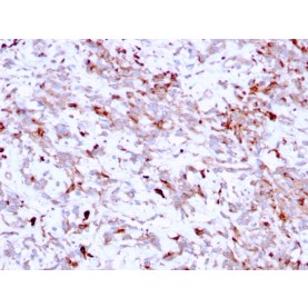 Biotium BNC402791-500, Cathepsin K (Marker of Tumor Invasiveness)(CTSK/2791), CF640R conjugate, 0.1mg/mL