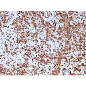 Biotium BNC402792-100, Cathepsin K (Marker of Tumor Invasiveness)(CTSK/2792), CF640R conjugate, 0.1mg/mL