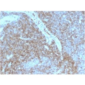 Biotium BNC402875-500, CD44 / HCAM Std. (HCAM/2875R), CF640R conjugate, 0.1mg/mL