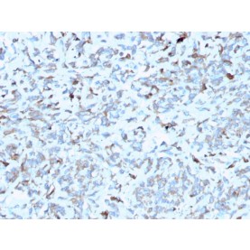 Biotium BNC402952-100, C1QA / Complement C1q A-Chain(C1QA/2952), CF640R conjugate, 0.1mg/mL