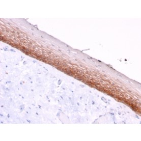 CD44v4/5 (Marker of Tumor Metastasis)(3D2), CF640R conjugate, 0.1mg/mL