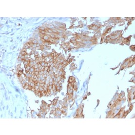 Uroplakin 1B (Urothelial Differentiation Marker)(UPK1B/3102), CF640R conjugate, 0.1mg/mL