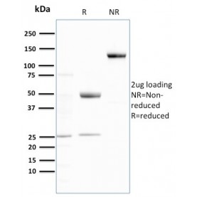 Ubiquitin (Autophagy Marker)(UBB/3143R), CF640R conjugate, 0.1mg/mL